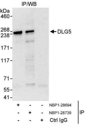 Immunoprecipitation: DLG5 Antibody [NBP1-28694]