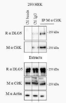 Immunoprecipitation: DLG5 Antibody [NBP1-28739]