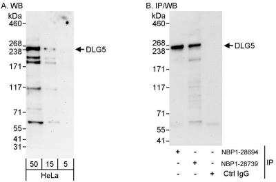 Western Blot: DLG5 Antibody [NBP1-28739]