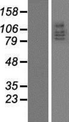 Western Blot: DLG5 Overexpression Lysate [NBP2-07830]