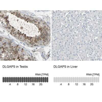 Immunohistochemistry-Paraffin: DLG7/HURP Antibody [NBP1-87976]