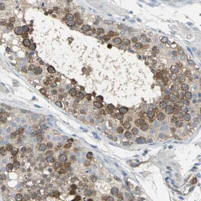 Immunohistochemistry-Paraffin: DLG7/HURP Antibody [NBP1-87976]