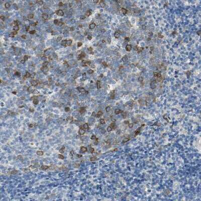 Immunohistochemistry-Paraffin: DLG7/HURP Antibody [NBP1-87976]