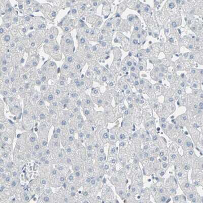 Immunohistochemistry-Paraffin: DLG7/HURP Antibody [NBP1-87976]