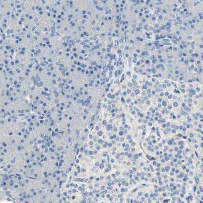 Immunohistochemistry-Paraffin: DLG7/HURP Antibody [NBP1-87976]