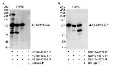 Immunoprecipitation: DLG7/HURP Antibody [NB110-40572]