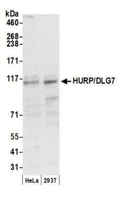 Western Blot: DLG7/HURP Antibody [NB110-40573]