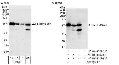 Western Blot: DLG7/HURP Antibody [NB110-40574]