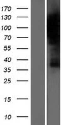 Western Blot: DLG7/HURP Overexpression Lysate [NBP2-10306]