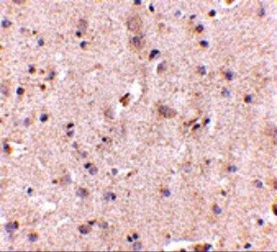 Immunohistochemistry: DLGAP2 Antibody - BSA Free [NBP2-82086]