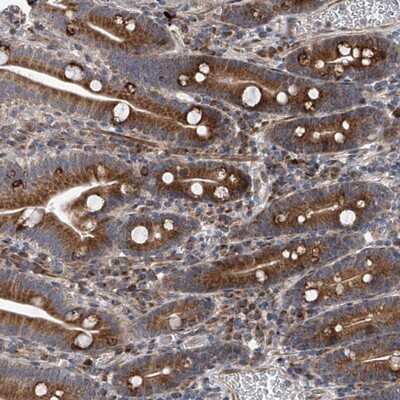 Immunohistochemistry-Paraffin: DLGAP2 Antibody [NBP1-90602]