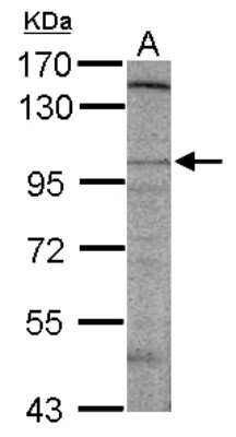 Western Blot: DLGAP2 Antibody [NBP2-16175]