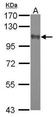 Western Blot: DLGAP2 Antibody [NBP2-42835]