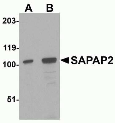 Western Blot: DLGAP2 AntibodyBSA Free [NBP2-82086]