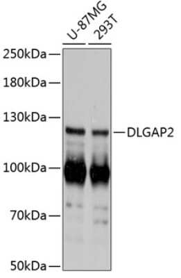 Western Blot: DLGAP2 AntibodyAzide and BSA Free [NBP3-05104]