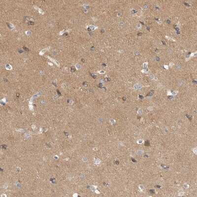 Immunohistochemistry-Paraffin: DLGAP3 Antibody [NBP1-90601]