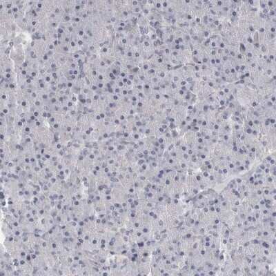 Immunohistochemistry-Paraffin: DLGAP3 Antibody [NBP1-90601]