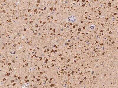 Immunohistochemistry-Paraffin: DLGAP3 Antibody [NBP3-05977]