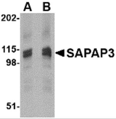 Western Blot: DLGAP3 AntibodyBSA Free [NBP2-81713]