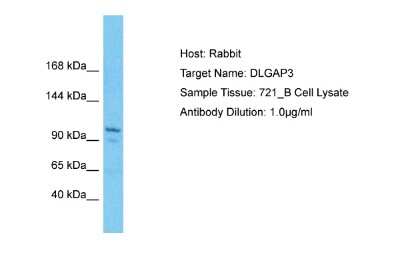 Western Blot: DLGAP3 Antibody [NBP2-82862]