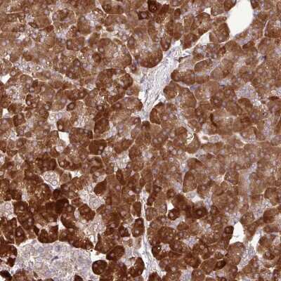 Immunohistochemistry: DLGAP4 Antibody [NBP2-33271]