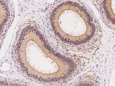 Immunohistochemistry-Paraffin: DLGAP4 Antibody [NBP2-98641]