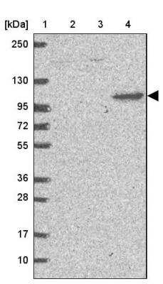 Western Blot: DLGAP4 Antibody [NBP2-33271]