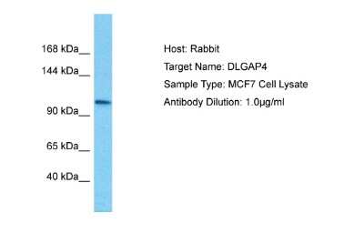 Western Blot: DLGAP4 Antibody [NBP2-87275]