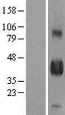 Western Blot: Pref-1/DLK1/FA1 Overexpression Lysate [NBL1-09913]