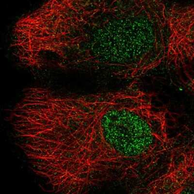 Immunocytochemistry/ Immunofluorescence: DLK2/EGFL9 Antibody [NBP2-55737]