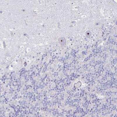 Immunohistochemistry-Paraffin: DLK2/EGFL9 Antibody [NBP2-31847]