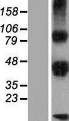 Western Blot: DLK2/EGFL9 Overexpression Lysate [NBP2-06371]