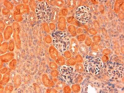 Immunohistochemistry: DLL1 Antibody [NB600-628]