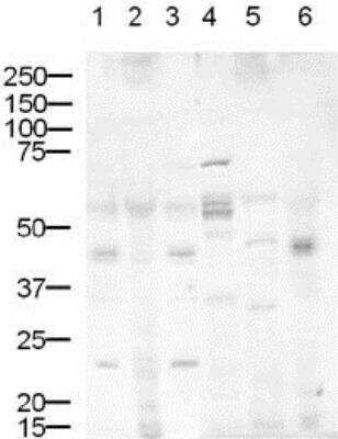 Western Blot: DLL1 Antibody [NB600-628]