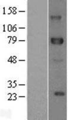 Western Blot: DLL1 Overexpression Lysate [NBL1-09914]