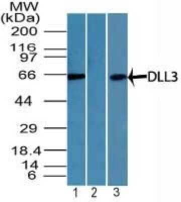 Western Blot: DLL3 Antibody [NBP2-24669]