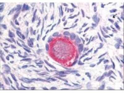 Immunohistochemistry: DLL4 Antibody [NB600-892]