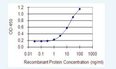 ELISA: DLST Antibody (4D7) [H00001743-M01-100ug]