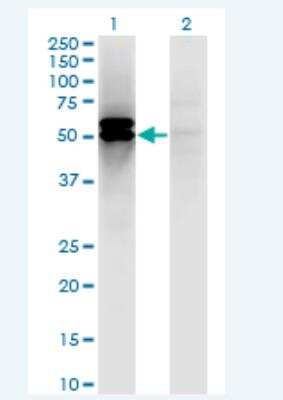 Western Blot: DLST Antibody (4D7) [H00001743-M01-100ug]