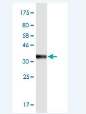 Western Blot: DLST Antibody (4D7) [H00001743-M01-100ug]