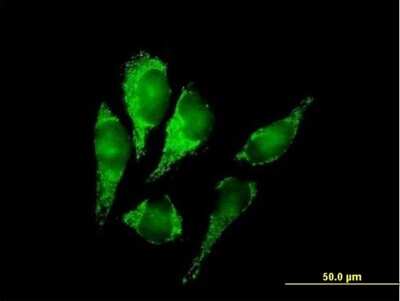 Immunocytochemistry/ Immunofluorescence: DLST Antibody [H00001743-B01P]