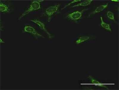 Immunocytochemistry/ Immunofluorescence: DLST Antibody [H00001743-D01P]