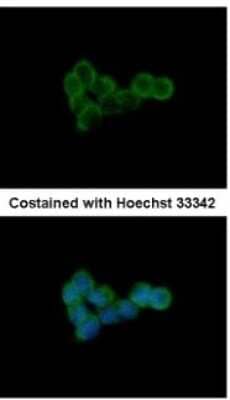 Immunocytochemistry/ Immunofluorescence: DLST Antibody [NBP1-31715]