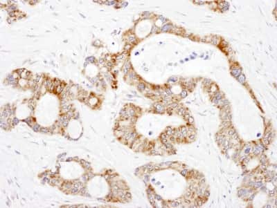 Immunohistochemistry-Paraffin: DLST Antibody [NBP2-32204]