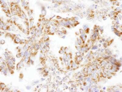 Immunohistochemistry-Paraffin: DLST Antibody [NBP2-32204]