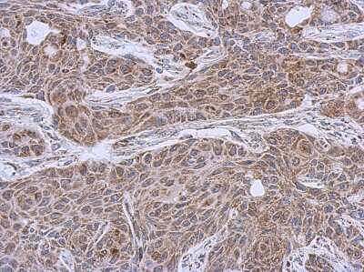 Immunohistochemistry-Paraffin: DLST Antibody [NBP1-31715]