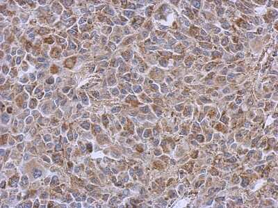 Immunohistochemistry-Paraffin: DLST Antibody [NBP1-31715]