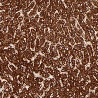 Immunohistochemistry-Paraffin: DLST Antibody [NBP1-85012]