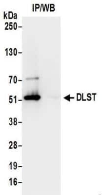 Immunoprecipitation: DLST Antibody [NBP2-32204]