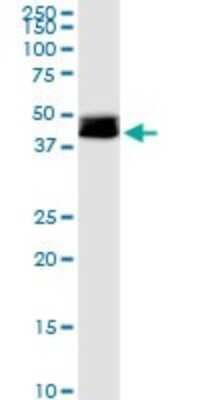 Western Blot: DLST Antibody [H00001743-B01P]